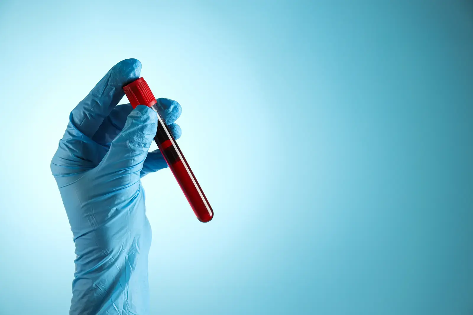 Blood tests now identify who needs Alzheimer's screening